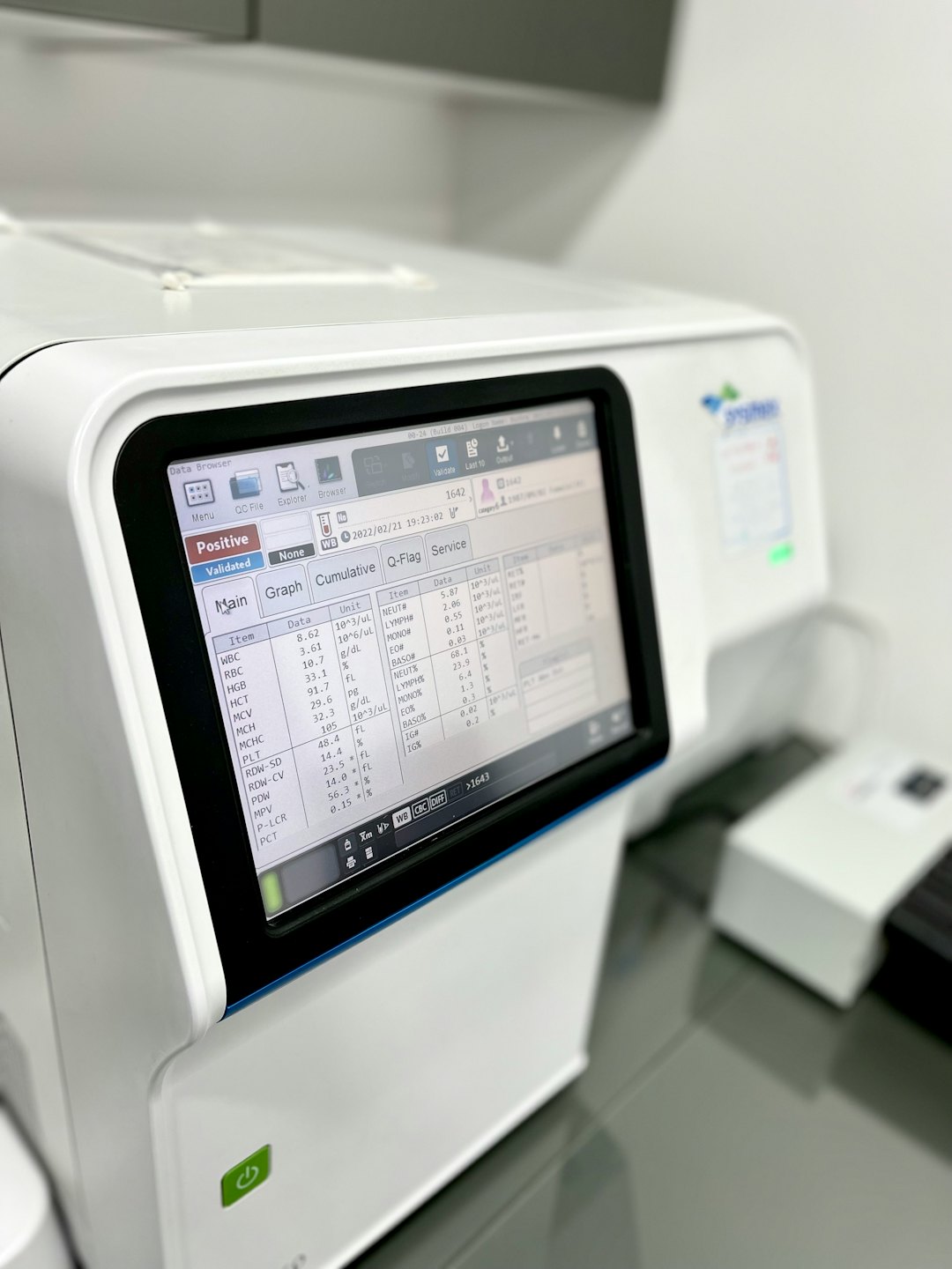 Hematologický analyzátor v lékařské laboratoři zobrazující výsledky krevních testů.